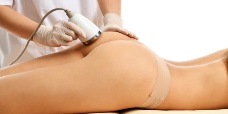 Tratamiento Cavitación Sisneo Corporal- LuxuryClínica