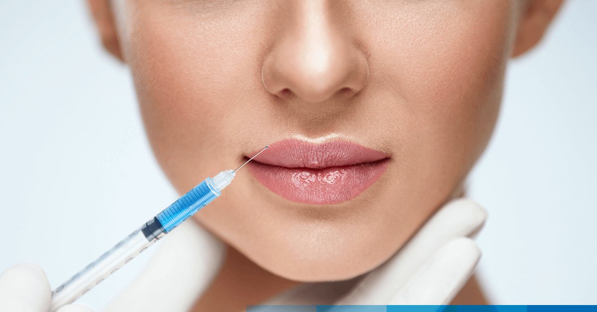 Tratamiento Labios Medicina Estética- LuxuryClínica